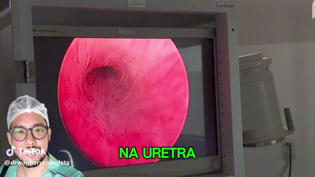 Preview for 20008193