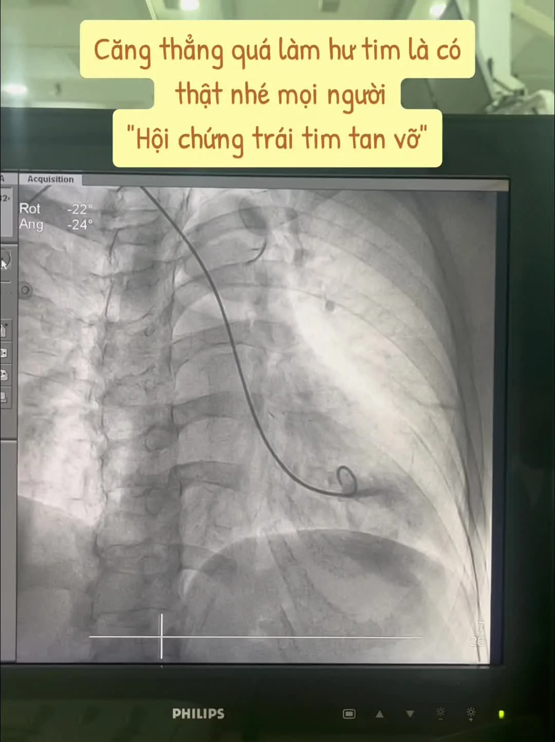 Preview for IMG 8894